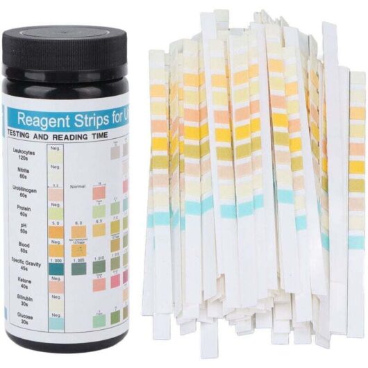Test Strips, Urine Analysis Ten Urine Ketone Test Ketone Body Test(100pcs)